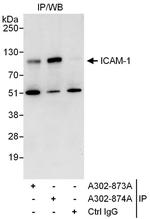ICAM-1 Antibody in Immunoprecipitation (IP)