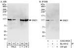 SND1 Antibody in Western Blot (WB)