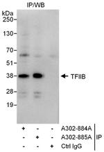 GTF2B/TFIIB Polyclonal Antibody