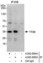 GTF2B/TFIIB Polyclonal Antibody