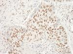 Aly Polyclonal Antibody