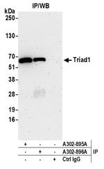 Triad1 Antibody in Immunoprecipitation (IP)