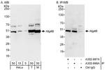 Atg4B Polyclonal Antibody