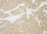 AUP1 Polyclonal Antibody
