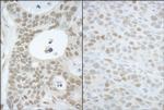 CAND1 Polyclonal Antibody