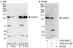 CAND1 Antibody in Western Blot (WB)