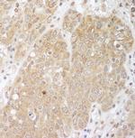 Cbl-b Polyclonal Antibody