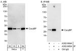 CacyBP Polyclonal Antibody