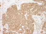 CacyBP Polyclonal Antibody