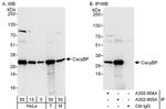 CacyBP Antibody in Western Blot (WB)