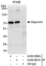 Gigaxonin Polyclonal Antibody