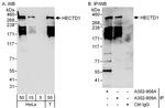HECTD1 Antibody in Western Blot (WB)
