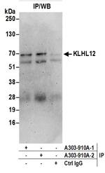 KLHL12 Polyclonal Antibody