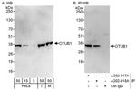 OTUB1 Polyclonal Antibody