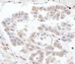 RABGEF1 Polyclonal Antibody