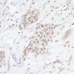 SAE1 Antibody in Immunohistochemistry (Paraffin) (IHC (P))