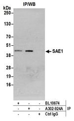 SAE1 Antibody in Immunoprecipitation (IP)