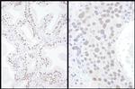 SAE2 Polyclonal Antibody