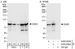 SAE2 Antibody in Western Blot (WB)
