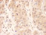 USP8 Polyclonal Antibody