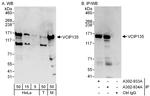 VCIP135 Polyclonal Antibody