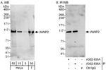 WWP2 Polyclonal Antibody
