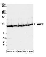 WWP2 Polyclonal Antibody