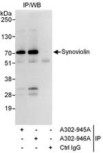 Synoviolin Polyclonal Antibody