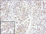UCH-L3 Polyclonal Antibody