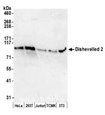 Dishevelled 2 Polyclonal Antibody