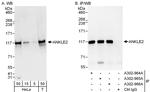 ANKLE2 Antibody in Western Blot (WB)
