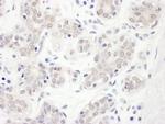 Hakai Polyclonal Antibody
