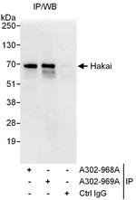 Hakai Antibody in Immunoprecipitation (IP)