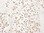 UBL7 Polyclonal Antibody