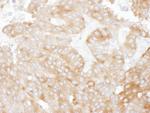 NHERF1 Polyclonal Antibody