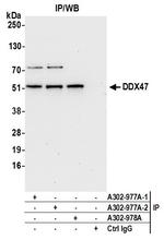 DDX47 Antibody in Immunoprecipitation (IP)