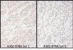 DDX56 Polyclonal Antibody