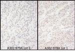 DDX56 Polyclonal Antibody