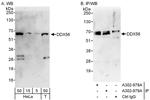 DDX56 Antibody in Western Blot (WB)