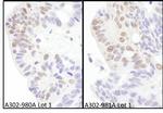 eIF4AIII/EIF4A3 Polyclonal Antibody
