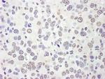 eIF4AIII/EIF4A3 Antibody in Immunohistochemistry (Paraffin) (IHC (P))