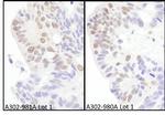 eIF4AIII/EIF4A3 Polyclonal Antibody