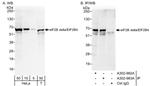eIF2B delta/EIF2B4 Antibody in Western Blot (WB)