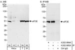 eIF3E Polyclonal Antibody