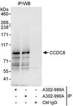 CCDC8 Antibody in Immunoprecipitation (IP)