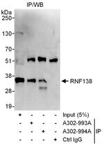 RNF138 Polyclonal Antibody