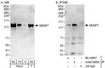 SENP7 Polyclonal Antibody