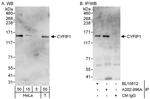 CYFIP1 Polyclonal Antibody