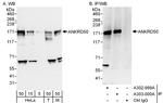 ANKRD50 Polyclonal Antibody