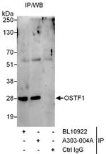 OSTF1 Polyclonal Antibody